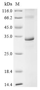 (Tris-Glycine gel) Discontinuous SDS-PAGE (reduced) with 5% enrichment gel and 15% separation gel.