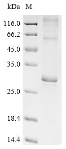 (Tris-Glycine gel) Discontinuous SDS-PAGE (reduced) with 5% enrichment gel and 15% separation gel.