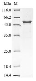 (Tris-Glycine gel) Discontinuous SDS-PAGE (reduced) with 5% enrichment gel and 15% separation gel.