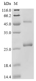 (Tris-Glycine gel) Discontinuous SDS-PAGE (reduced) with 5% enrichment gel and 15% separation gel.
