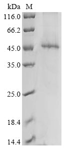 (Tris-Glycine gel) Discontinuous SDS-PAGE (reduced) with 5% enrichment gel and 15% separation gel.