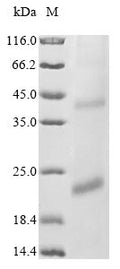 (Tris-Glycine gel) Discontinuous SDS-PAGE (reduced) with 5% enrichment gel and 15% separation gel.