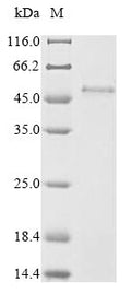 (Tris-Glycine gel) Discontinuous SDS-PAGE (reduced) with 5% enrichment gel and 15% separation gel.
