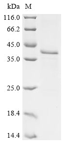 (Tris-Glycine gel) Discontinuous SDS-PAGE (reduced) with 5% enrichment gel and 15% separation gel.