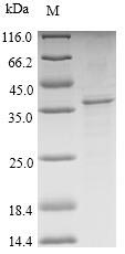 (Tris-Glycine gel) Discontinuous SDS-PAGE (reduced) with 5% enrichment gel and 15% separation gel.