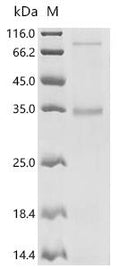 (Tris-Glycine gel) Discontinuous SDS-PAGE (reduced) with 5% enrichment gel and 15% separation gel.