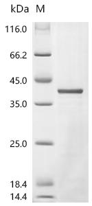(Tris-Glycine gel) Discontinuous SDS-PAGE (reduced) with 5% enrichment gel and 15% separation gel.