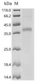 (Tris-Glycine gel) Discontinuous SDS-PAGE (reduced) with 5% enrichment gel and 15% separation gel.