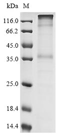 (Tris-Glycine gel) Discontinuous SDS-PAGE (reduced) with 5% enrichment gel and 15% separation gel.