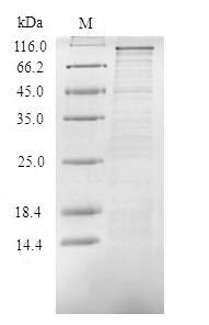 (Tris-Glycine gel) Discontinuous SDS-PAGE (reduced) with 5% enrichment gel and 15% separation gel.
