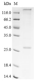 (Tris-Glycine gel) Discontinuous SDS-PAGE (reduced) with 5% enrichment gel and 15% separation gel.