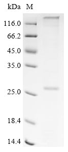 (Tris-Glycine gel) Discontinuous SDS-PAGE (reduced) with 5% enrichment gel and 15% separation gel.