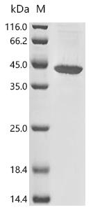 (Tris-Glycine gel) Discontinuous SDS-PAGE (reduced) with 5% enrichment gel and 15% separation gel.