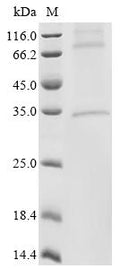 (Tris-Glycine gel) Discontinuous SDS-PAGE (reduced) with 5% enrichment gel and 15% separation gel.
