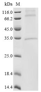 (Tris-Glycine gel) Discontinuous SDS-PAGE (reduced) with 5% enrichment gel and 15% separation gel.