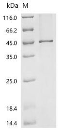 (Tris-Glycine gel) Discontinuous SDS-PAGE (reduced) with 5% enrichment gel and 15% separation gel.