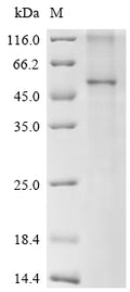 (Tris-Glycine gel) Discontinuous SDS-PAGE (reduced) with 5% enrichment gel and 15% separation gel.