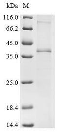 (Tris-Glycine gel) Discontinuous SDS-PAGE (reduced) with 5% enrichment gel and 15% separation gel.