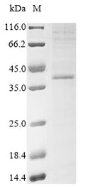 (Tris-Glycine gel) Discontinuous SDS-PAGE (reduced) with 5% enrichment gel and 15% separation gel.