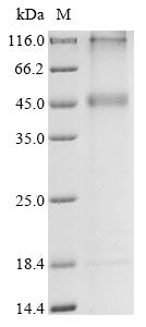 (Tris-Glycine gel) Discontinuous SDS-PAGE (reduced) with 5% enrichment gel and 15% separation gel.