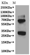 (Tris-Glycine gel) Discontinuous SDS-PAGE (reduced) with 5% enrichment gel and 15% separation gel.
