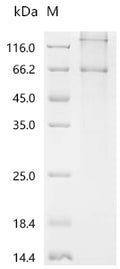 Recombinant Dog Parathyroid hormone/parathyroid hormone-related peptide receptor (PTH1R) – Figure 1 of 1
