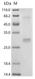 (Tris-Glycine gel) Discontinuous SDS-PAGE (reduced) with 5% enrichment gel and 15% separation gel.