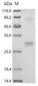 (Tris-Glycine gel) Discontinuous SDS-PAGE (reduced) with 5% enrichment gel and 15% separation gel.