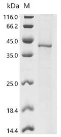 (Tris-Glycine gel) Discontinuous SDS-PAGE (reduced) with 5% enrichment gel and 15% separation gel.
