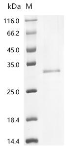 (Tris-Glycine gel) Discontinuous SDS-PAGE (reduced) with 5% enrichment gel and 15% separation gel.