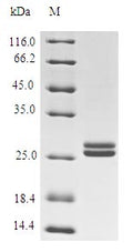 (Tris-Glycine gel) Discontinuous SDS-PAGE (reduced) with 5% enrichment gel and 15% separation gel.