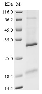 (Tris-Glycine gel) Discontinuous SDS-PAGE (reduced) with 5% enrichment gel and 15% separation gel.