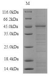 (Tris-Glycine gel) Discontinuous SDS-PAGE (reduced) with 5% enrichment gel and 15% separation gel.