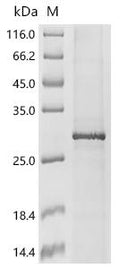 (Tris-Glycine gel) Discontinuous SDS-PAGE (reduced) with 5% enrichment gel and 15% separation gel.