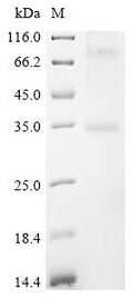 (Tris-Glycine gel) Discontinuous SDS-PAGE (reduced) with 5% enrichment gel and 15% separation gel.