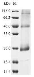 (Tris-Glycine gel) Discontinuous SDS-PAGE (reduced) with 5% enrichment gel and 15% separation gel.