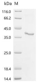 (Tris-Glycine gel) Discontinuous SDS-PAGE (reduced) with 5% enrichment gel and 15% separation gel.