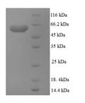 Recombinant Mouse Multidrug resistance protein 3 (Abcb4), partial – Figure 1 of 1