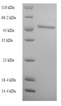 Recombinant Human 3-ketoacyl-CoA thiolase, peroxisomal (ACAA1) – Figure 1 of 1