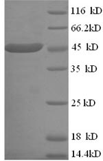 Recombinant Human 3-ketoacyl-CoA thiolase, mitochondrial (ACAA2) – Figure 1 of 1