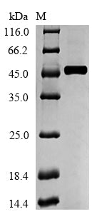 Recombinant Human Medium-chain specific acyl-CoA dehydrogenase, mitochondrial (ACADM) – Figure 1 of 1