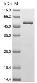 (Tris-Glycine gel) Discontinuous SDS-PAGE (reduced) with 5% enrichment gel and 15% separation gel.