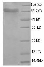Recombinant Bovine Acetylcholinesterase (ACHE) – Figure 1 of 1
