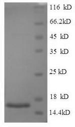 Recombinant Human Acrosomal protein SP-10 (ACRV1) – Figure 1 of 1