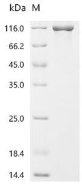 (Tris-Glycine gel) Discontinuous SDS-PAGE (reduced) with 5% enrichment gel and 15% separation gel.