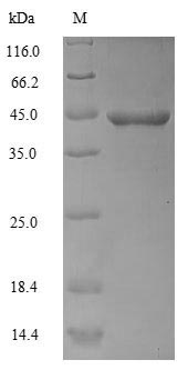 Recombinant Human Actin, alpha skeletal muscle (ACTA1) – Figure 1 of 1