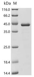 (Tris-Glycine gel) Discontinuous SDS-PAGE (reduced) with 5% enrichment gel and 15% separation gel.