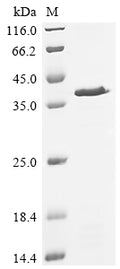 (Tris-Glycine gel) Discontinuous SDS-PAGE (reduced) with 5% enrichment gel and 15% separation gel.