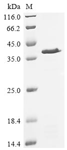 (Tris-Glycine gel) Discontinuous SDS-PAGE (reduced) with 5% enrichment gel and 15% separation gel.