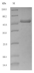 Recombinant Escherichia coli Adenosine deaminase (add) – Figure 1 of 1